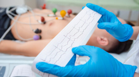 Mejor Curso de Electrocardiografia Online