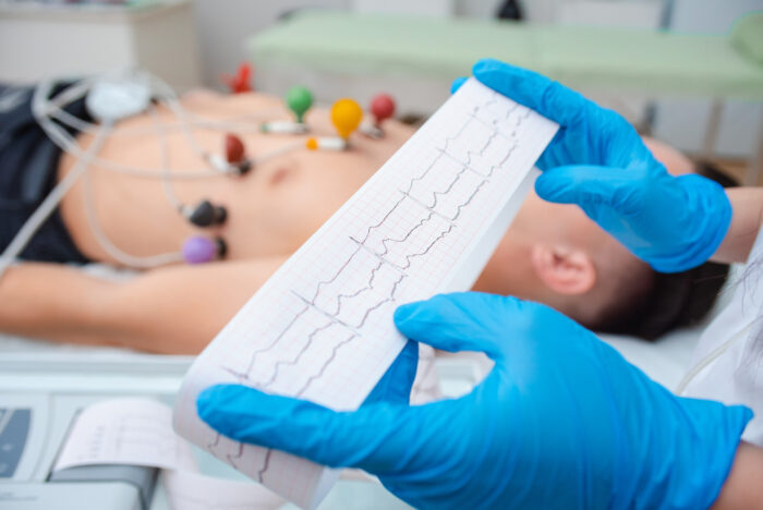 Mejor Curso de Electrocardiografia Online