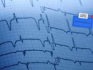 Curso de Electrocardiografia